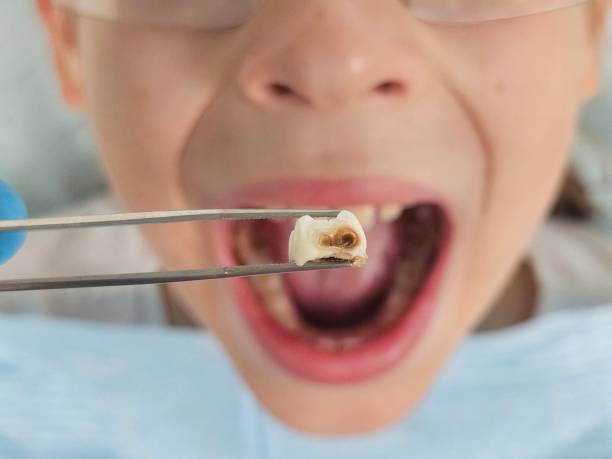 Best Emergency Treatment for Oral Infections in Malvern, PA